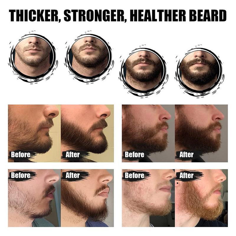 Juego de 5 uds de barba para h - Men'S Grooming Tonic reseña y precio
